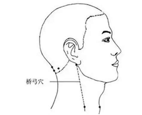 橋弓穴位置|身體的6個應急穴位，高血壓按摩橋弓穴